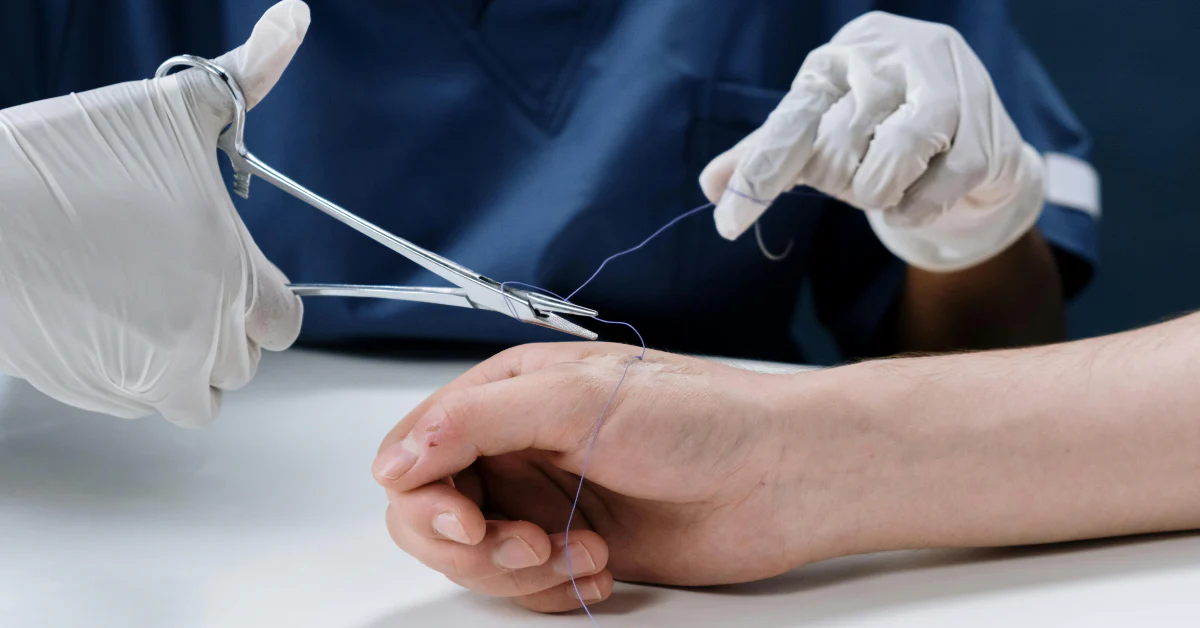 suture-removal-at-home-in-gurgaon