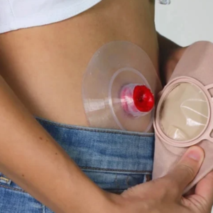 colostomy-bag-change-at-home-in-gurgaon