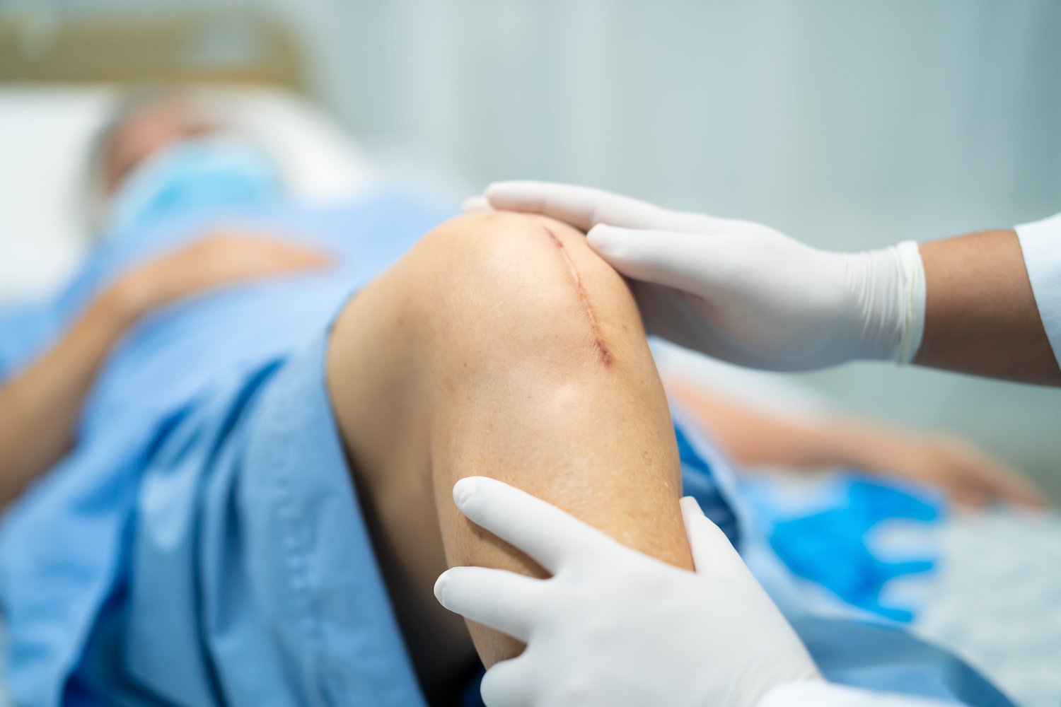 suture-removal-at-home-in-gurgaon