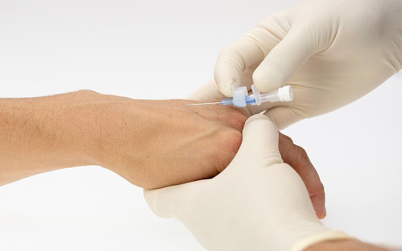 cannula-insertion-at-home-in-gurgaon